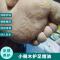 脚臭脚痒专业护理精油